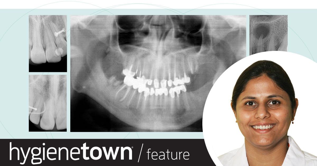 Test Your Reading Comprehension How well can you interpret what’s visible in dental radiographs?