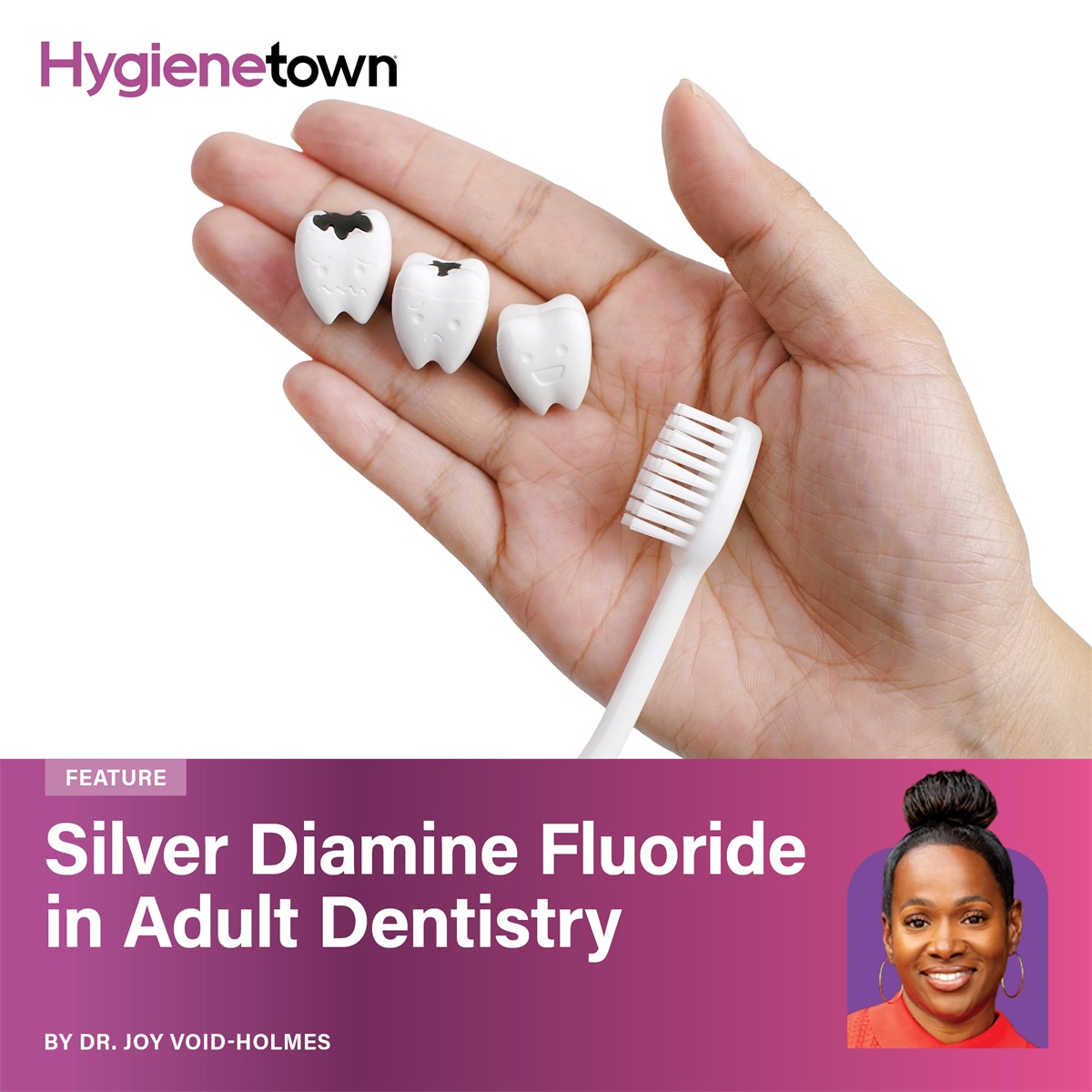 Silver Diamine Fluoride in Adult Dentistry Dr. Joy Void-Holmes examines the growing evidence behind silver diamine fluoride as a minimally invasive option for managing deep caries in adult patients.