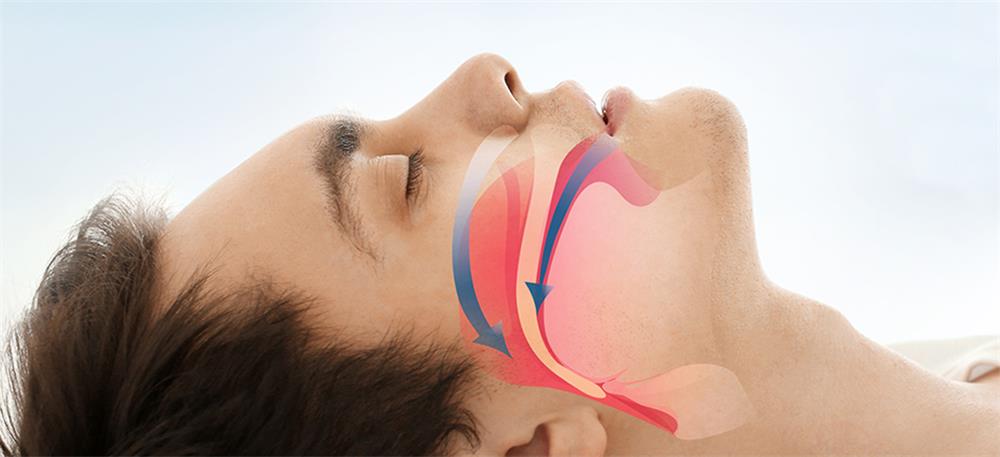 Hygienists: First Responders for the Airway