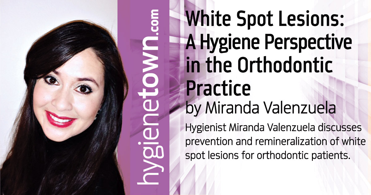 Header: White Spot Lesions: A Hygiene Perspective in the Orthodontic Practice