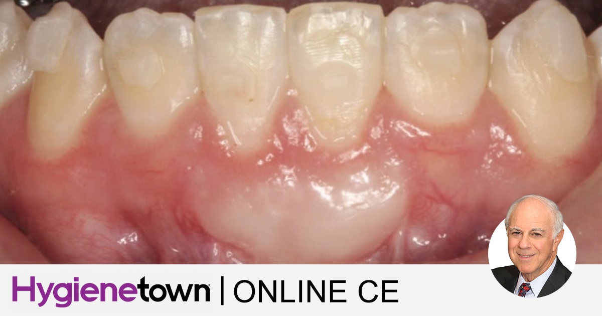 Improving Restorative Results with Soft Tissue Grafting