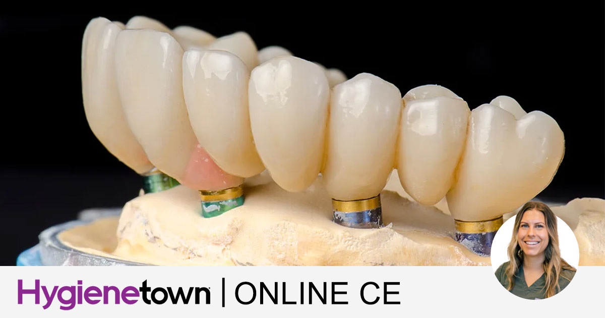 Kirsta Herring, BCH, RDH All-On-Four Implant Maintenance (AO4) for Registered Dental Hygienists